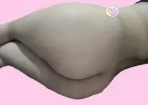 1000041446.webp