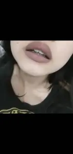 291ab824e14e97820b50bae8937fdd85.webp 291ab824e14e97820b50bae8937fdd85.webp