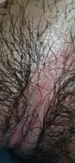 1000789376.webp
