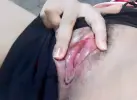 1000179136.webp