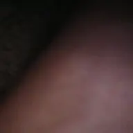Castibg1