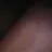 Castibg1